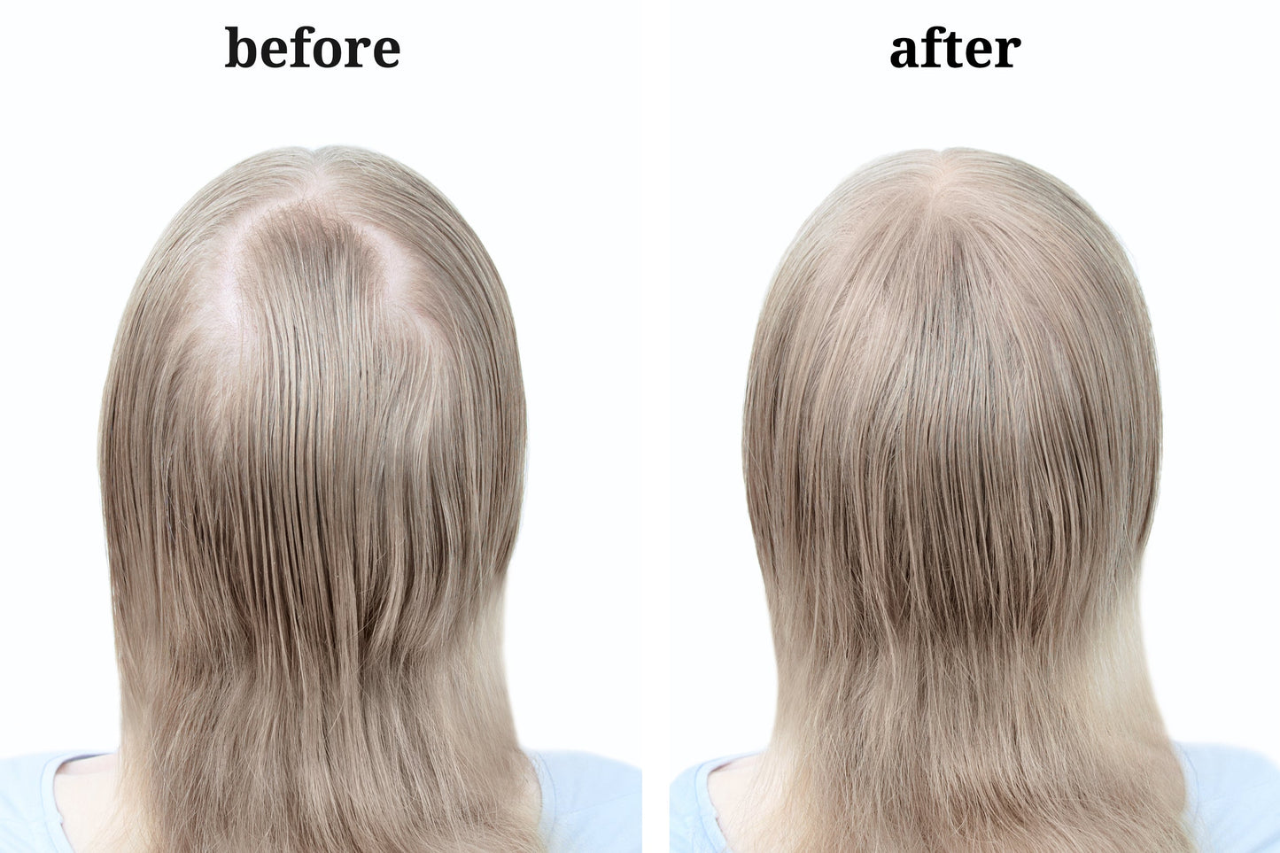 Hair Grow Restore: DMAE with MSM- Mermaid Hair Don't Care