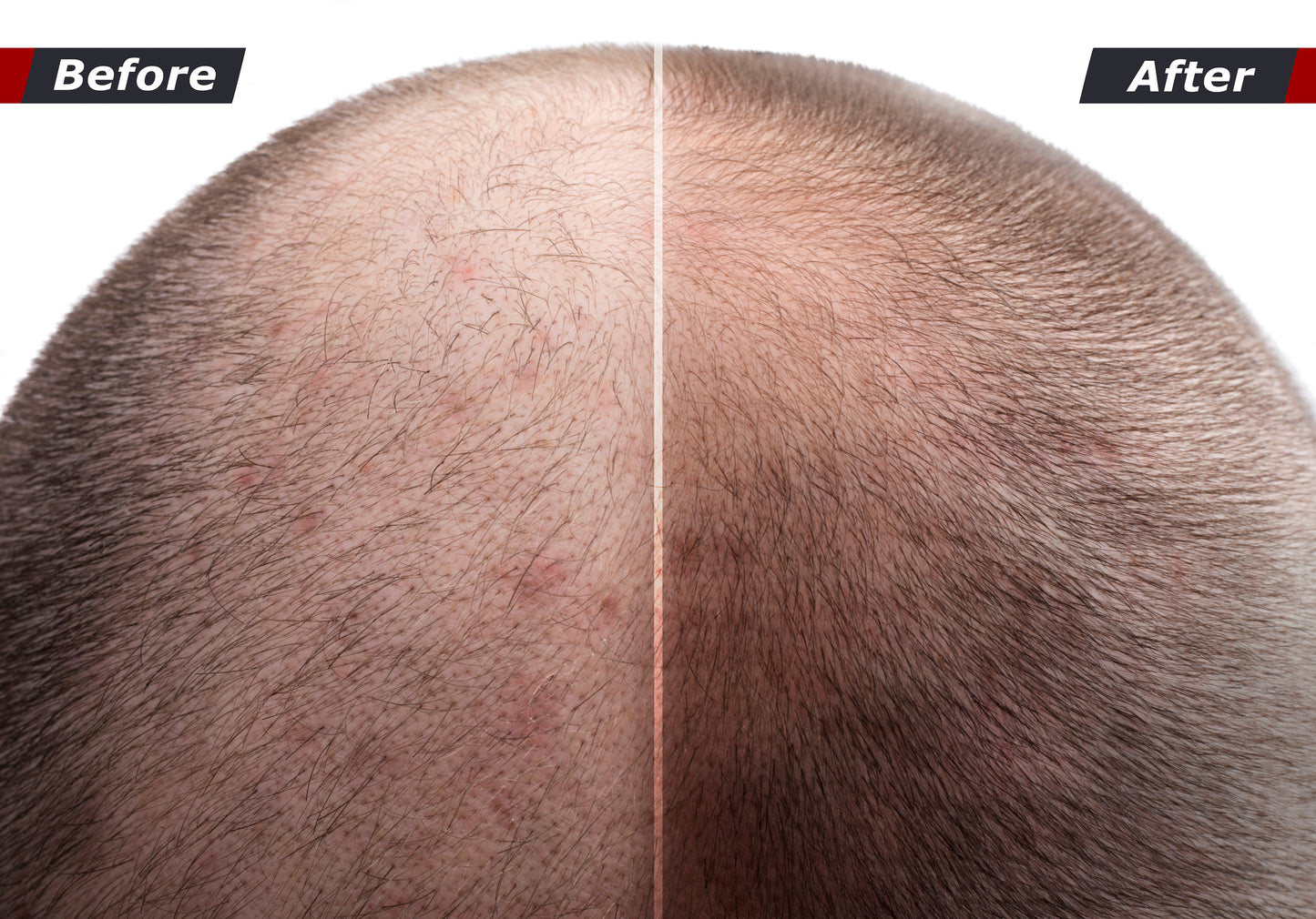 Mermaid Hair Thicken & Grow Hair Serum- Restore